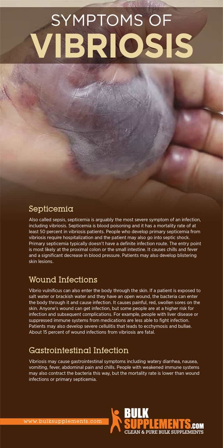 What is Vibriosis Causes, Symptoms & Treatment