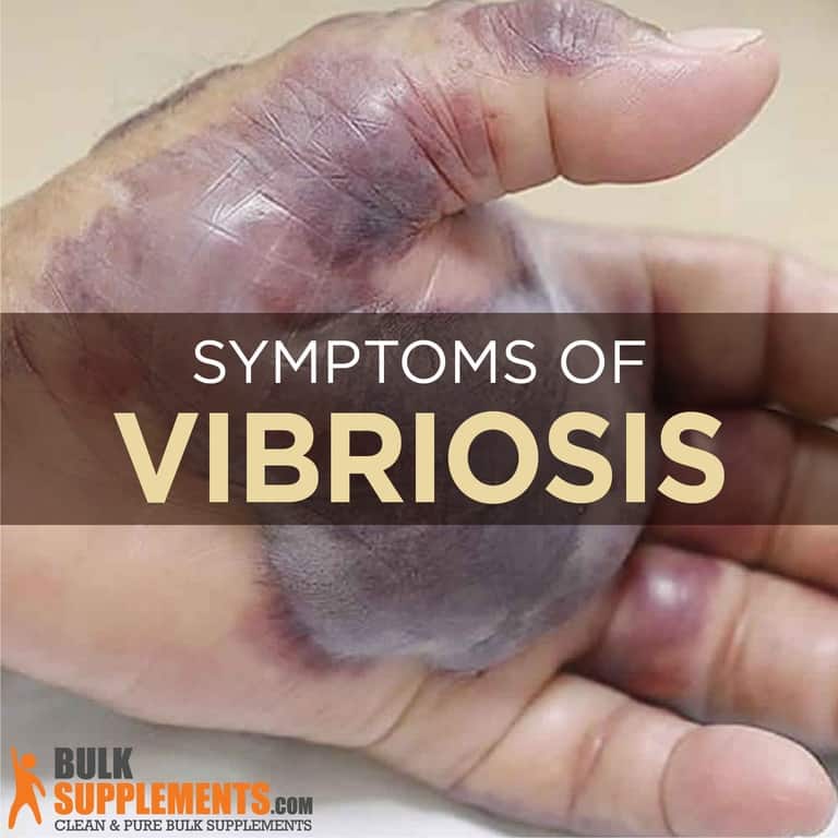 Vibriosis: What You Need To Know To Protect Yourself