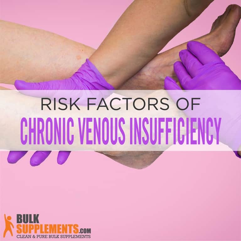 Chronic Venous Insufficiency Causes, Symptoms & Treatment