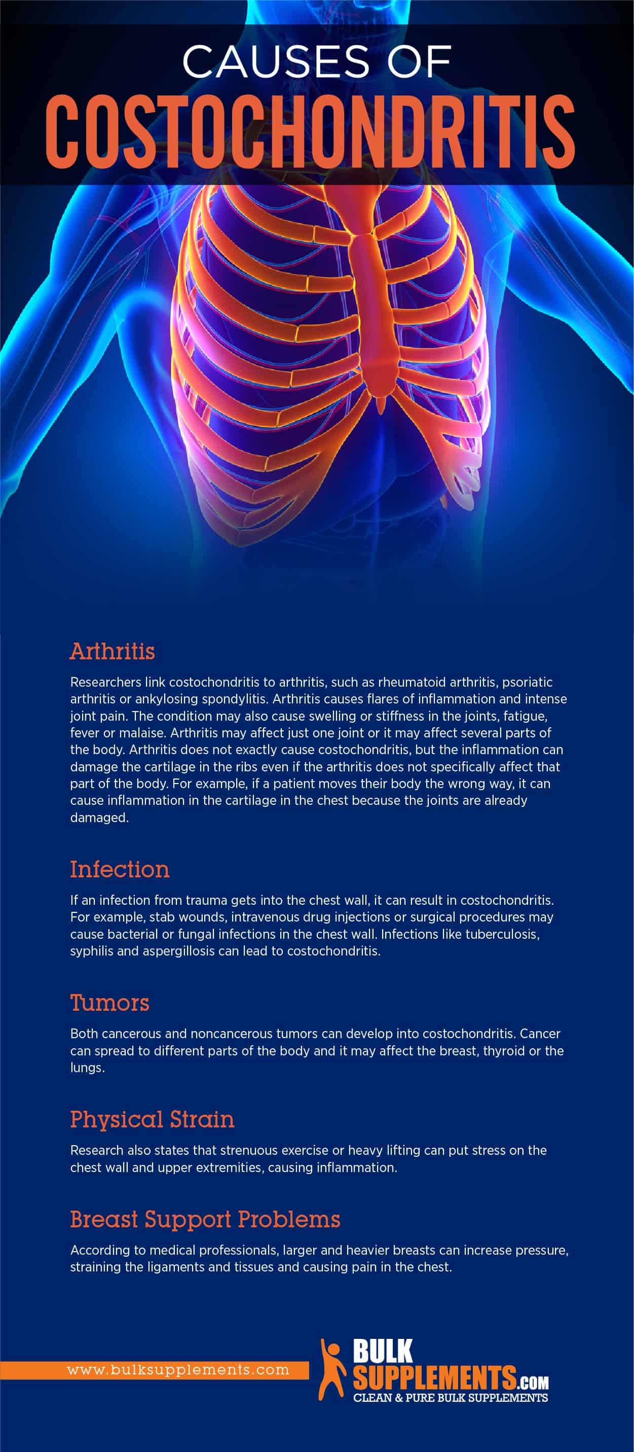 Costochondritis