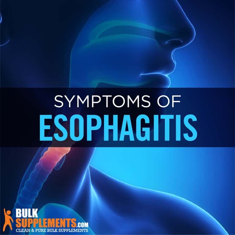 Esophagitis Symptoms Causes And Treatment