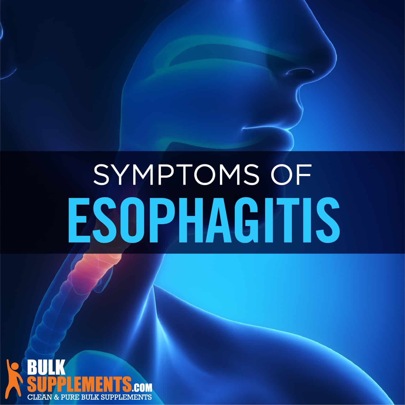 Candida esophagitis as related to Sore Throat - Pictures