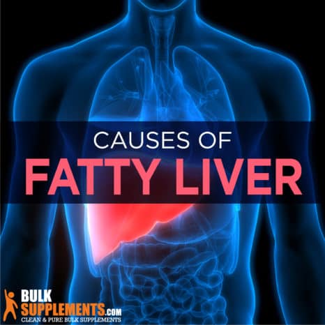 Fatty Liver Disease. Get the Supplements You Need.