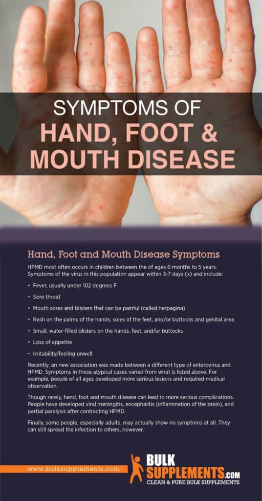 Hand, Foot, and Mouth Disease. Everything You Need to Know About It