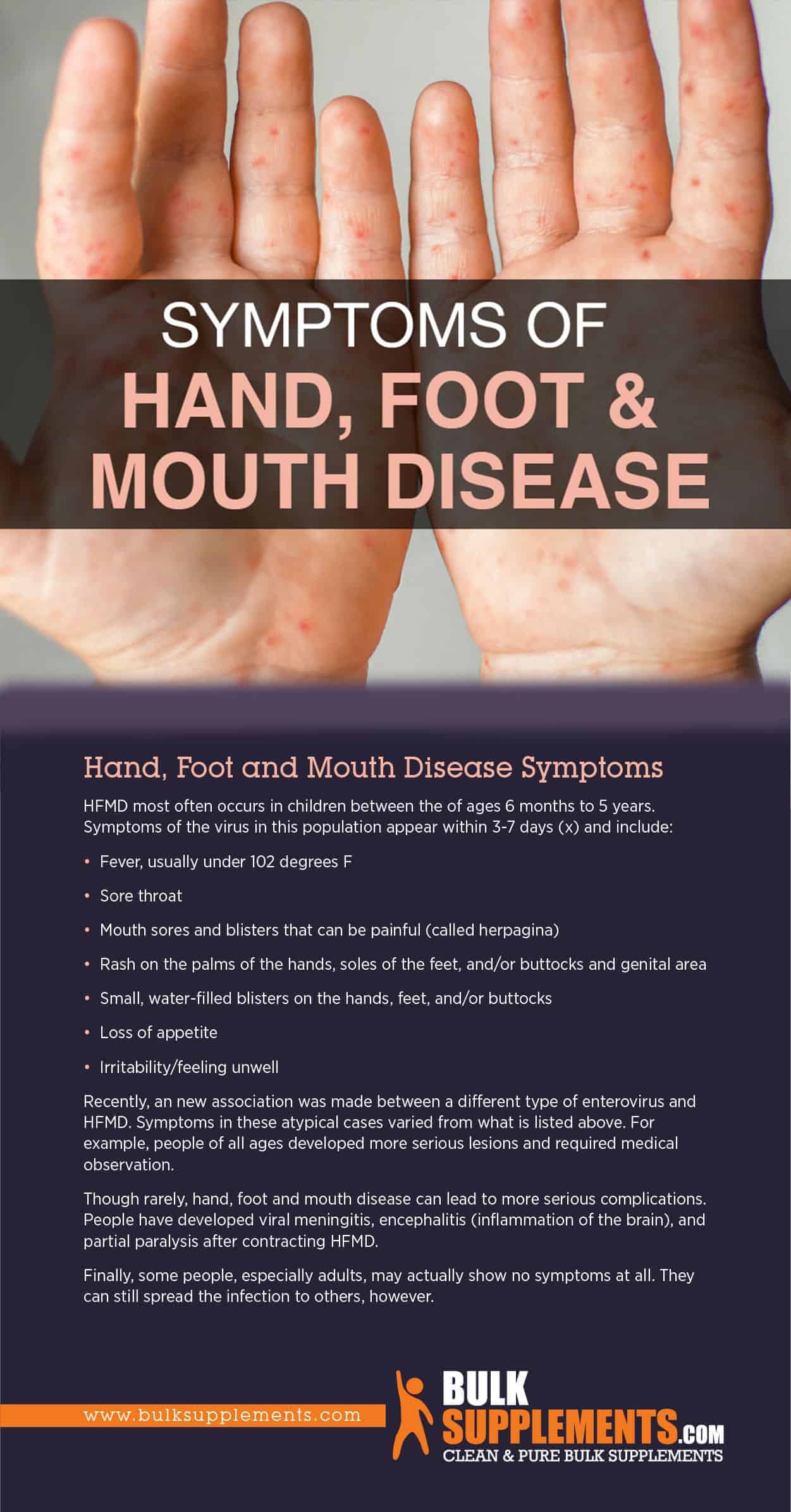 SYMPTOMS OF HAND, FOOT, AND MOUTH DISEASE