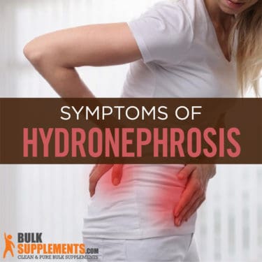 Hydronephrosis. Get Relief & Treat Your Swelling Kidney Effectively