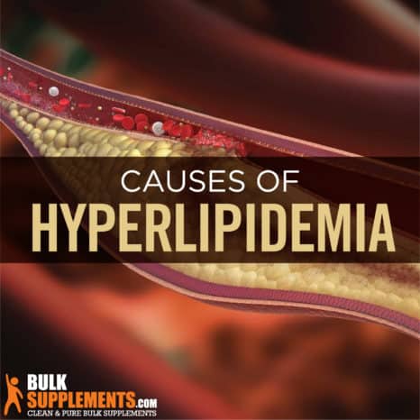 Hyperlipidemia. Keep your Cholesterol in Check! Ask about Supplements.