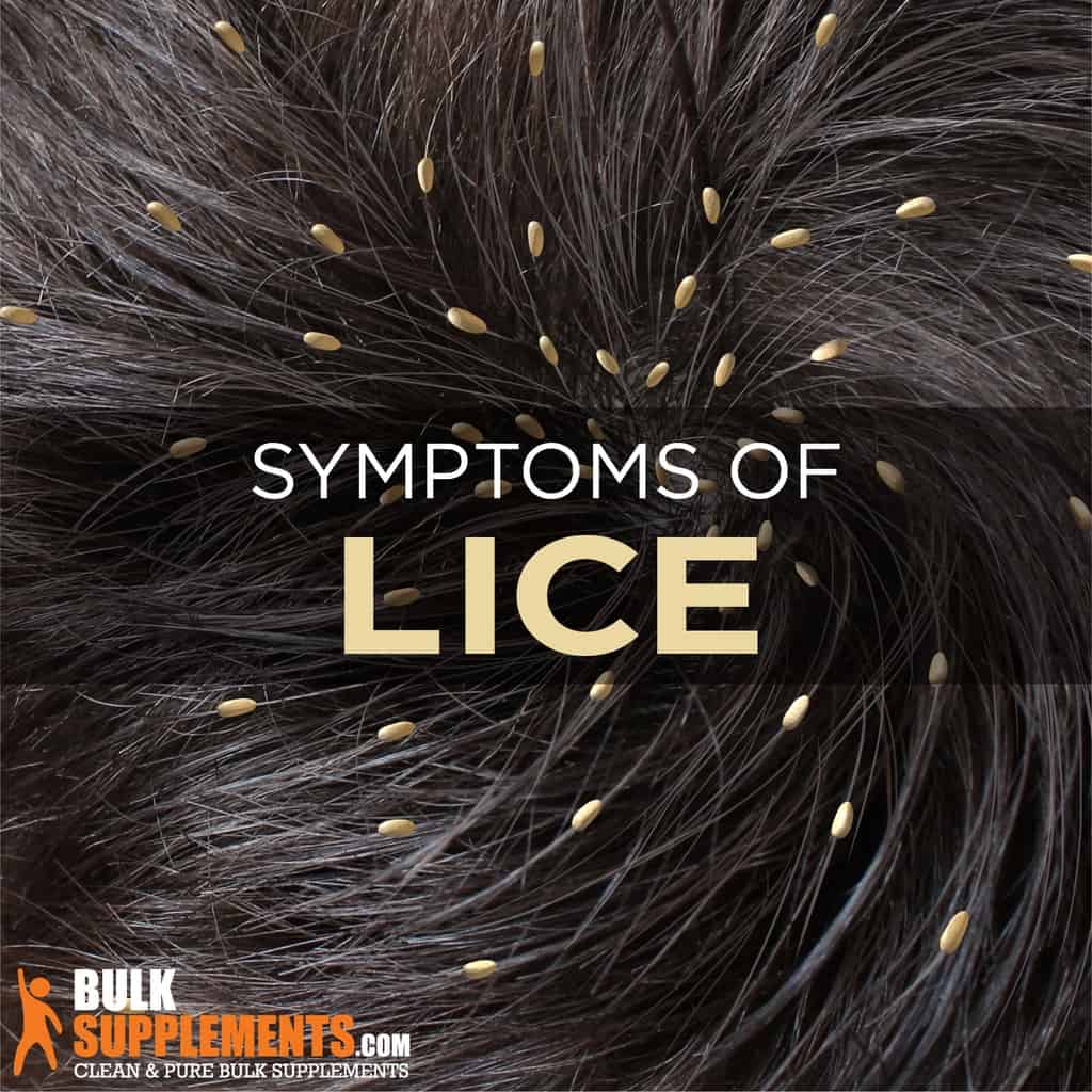 Lice Symptoms, Causes & Treatment
