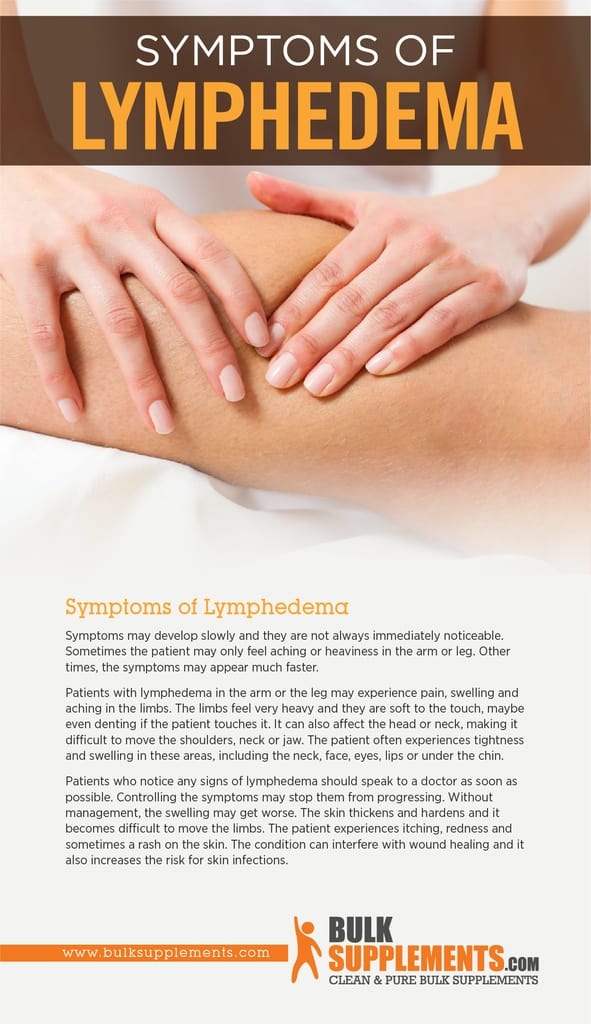 What Is Lymphedema: Symptoms, Causes & Treatments