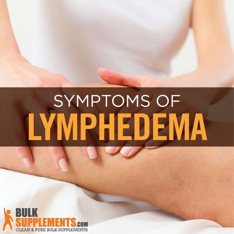 What is Lymphedema: Symptoms, Causes & Treatments