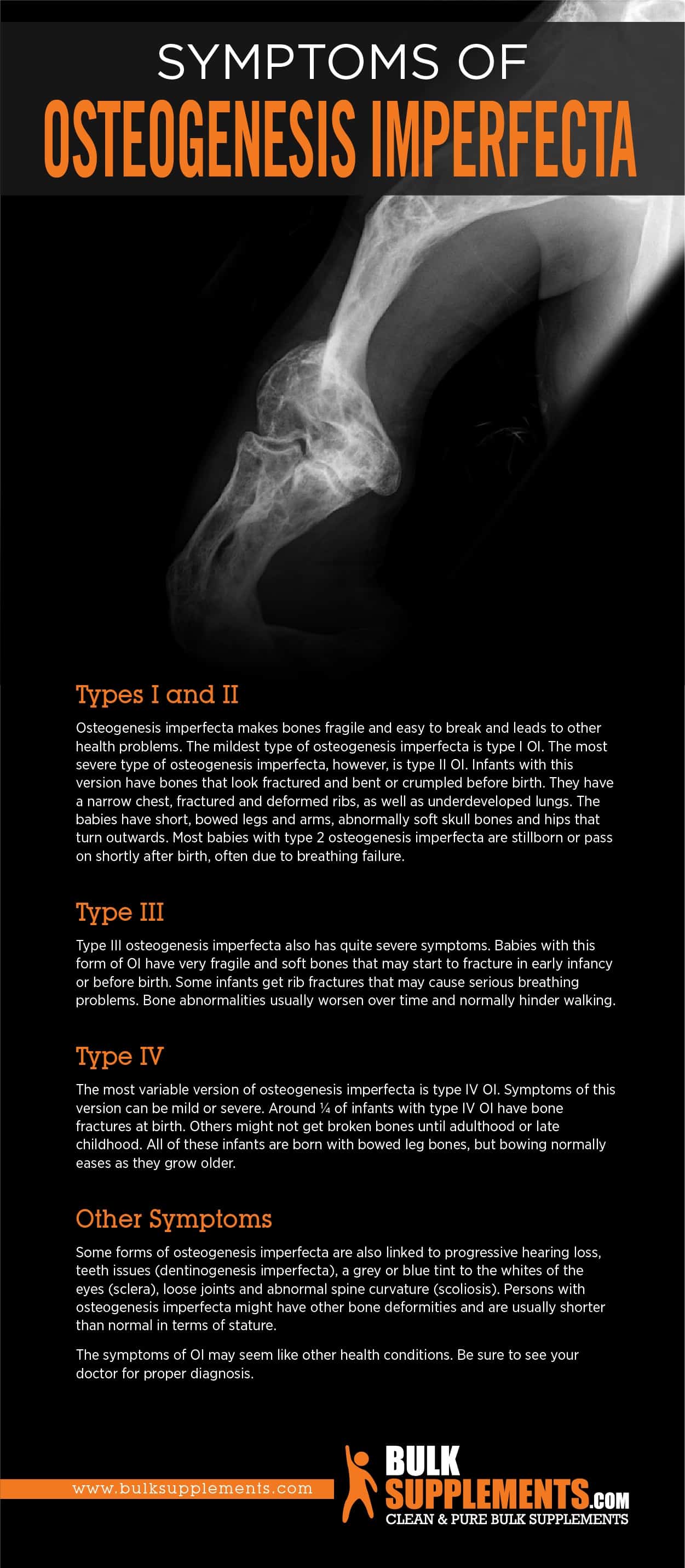 Symptoms of Osteogenesis Imperfecta