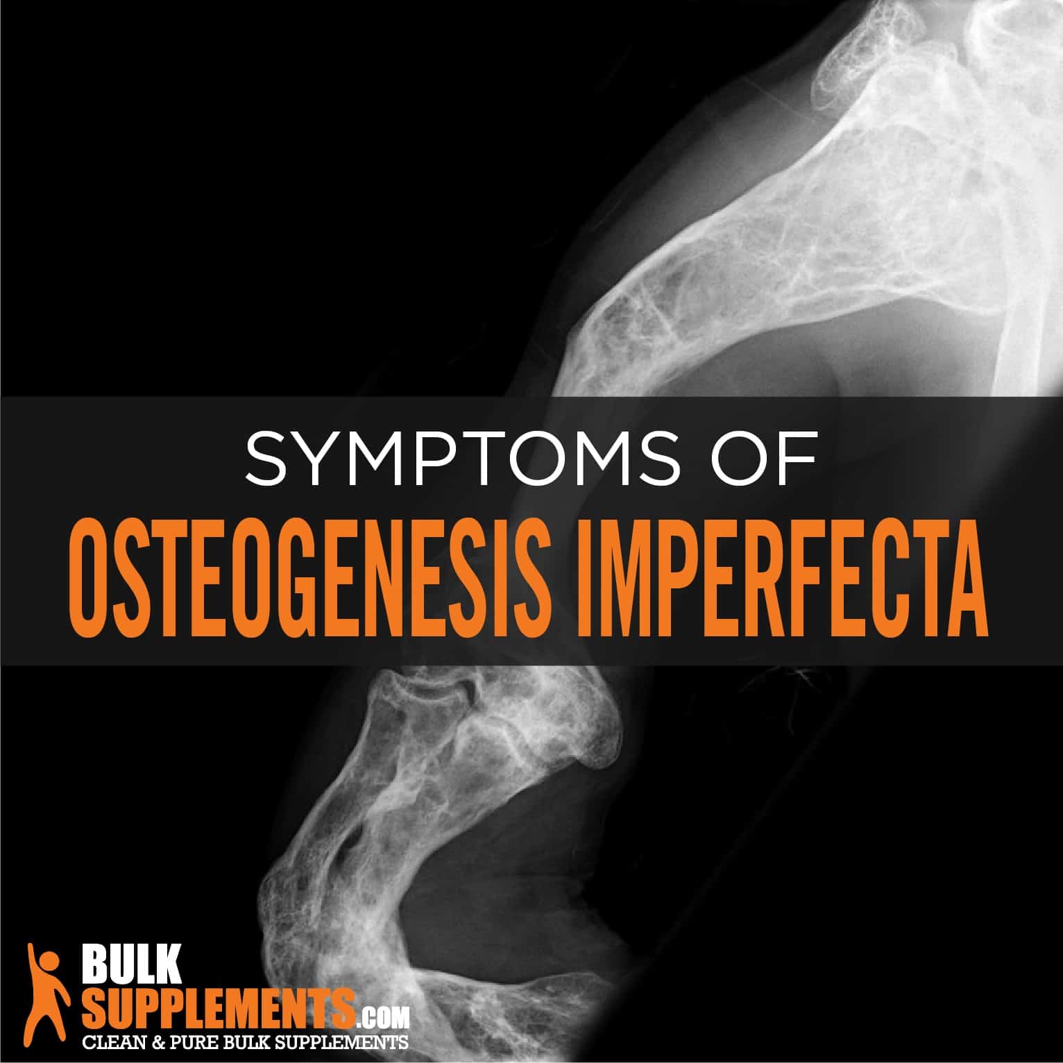 Understanding Osteogenesis Imperfecta: The Fragile Bone Disorder - Common symptoms of OI