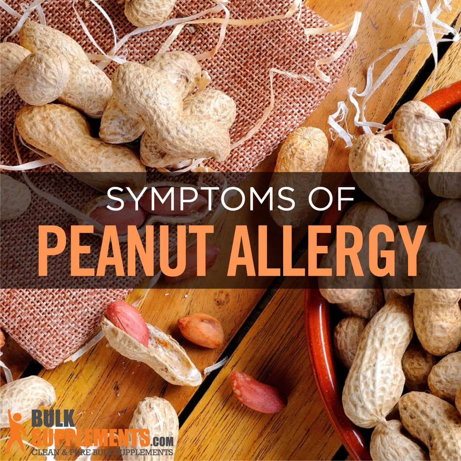 peanut allergy