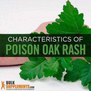 Poison Oak Rash: Causes, Characteristics & Treatment