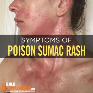 Poison Sumac. Don't Let It Win. Take Control and Soothe Rash Symptoms.