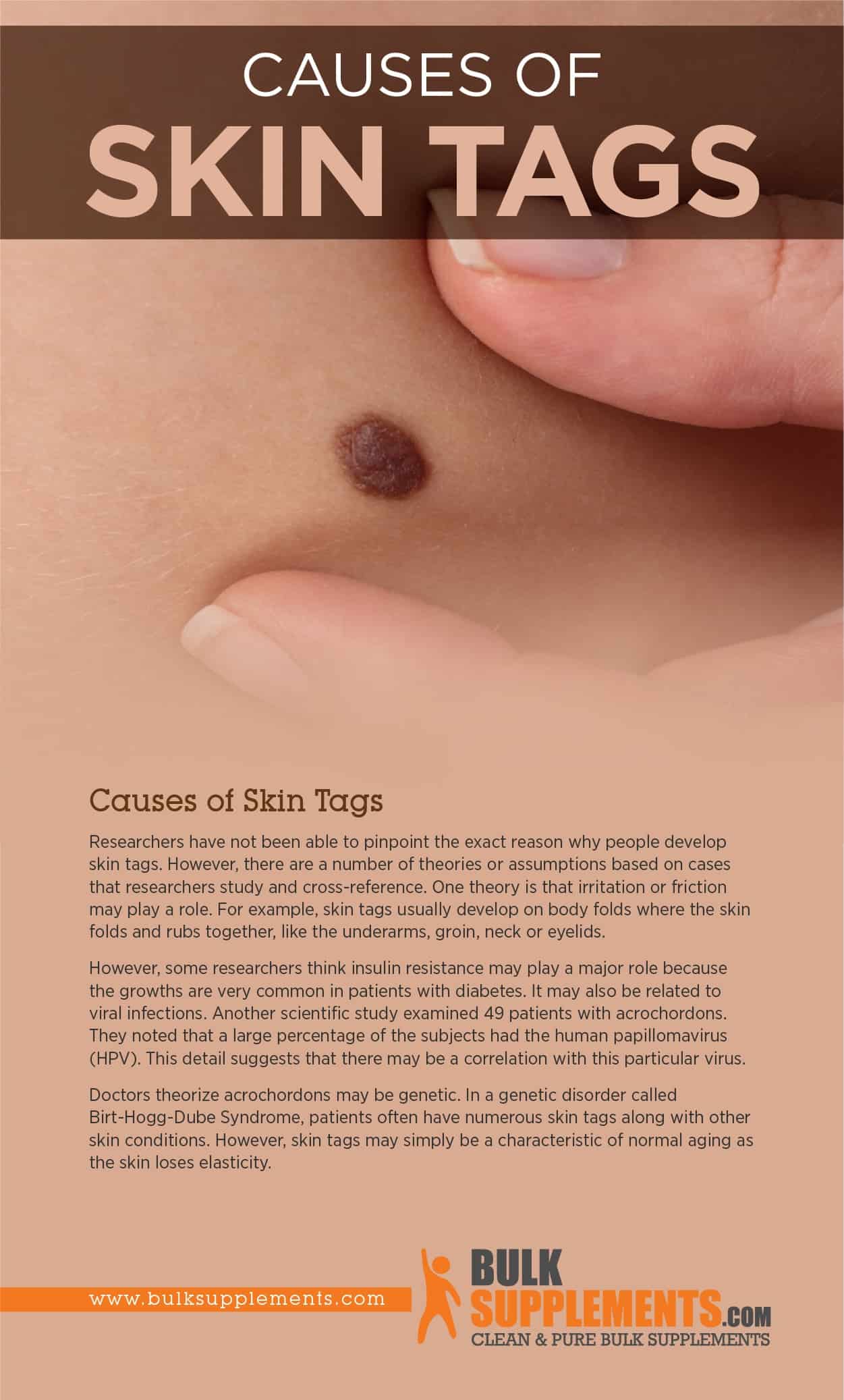 Causes of Skin Tags
