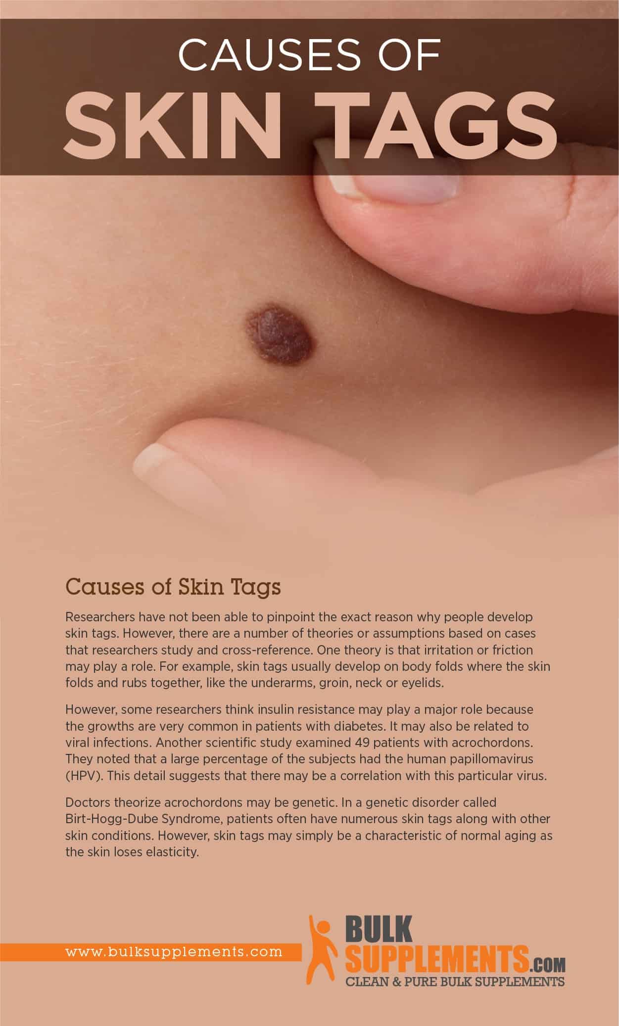 what-virus-causes-skin-tags