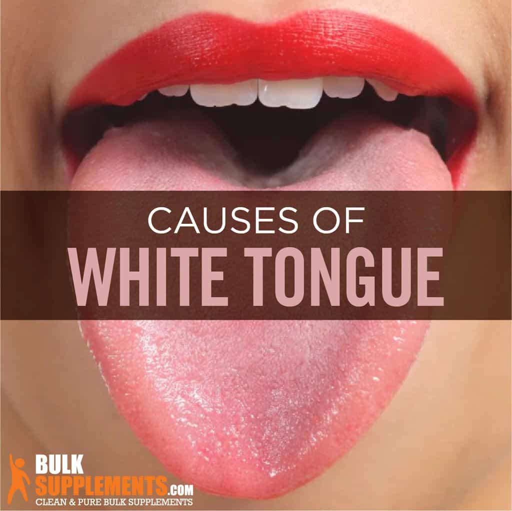White Tongue: Symptoms, Causes & Treatment