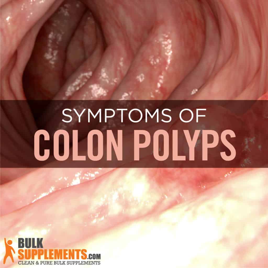 What Do Colon Polyps Look Like Archives