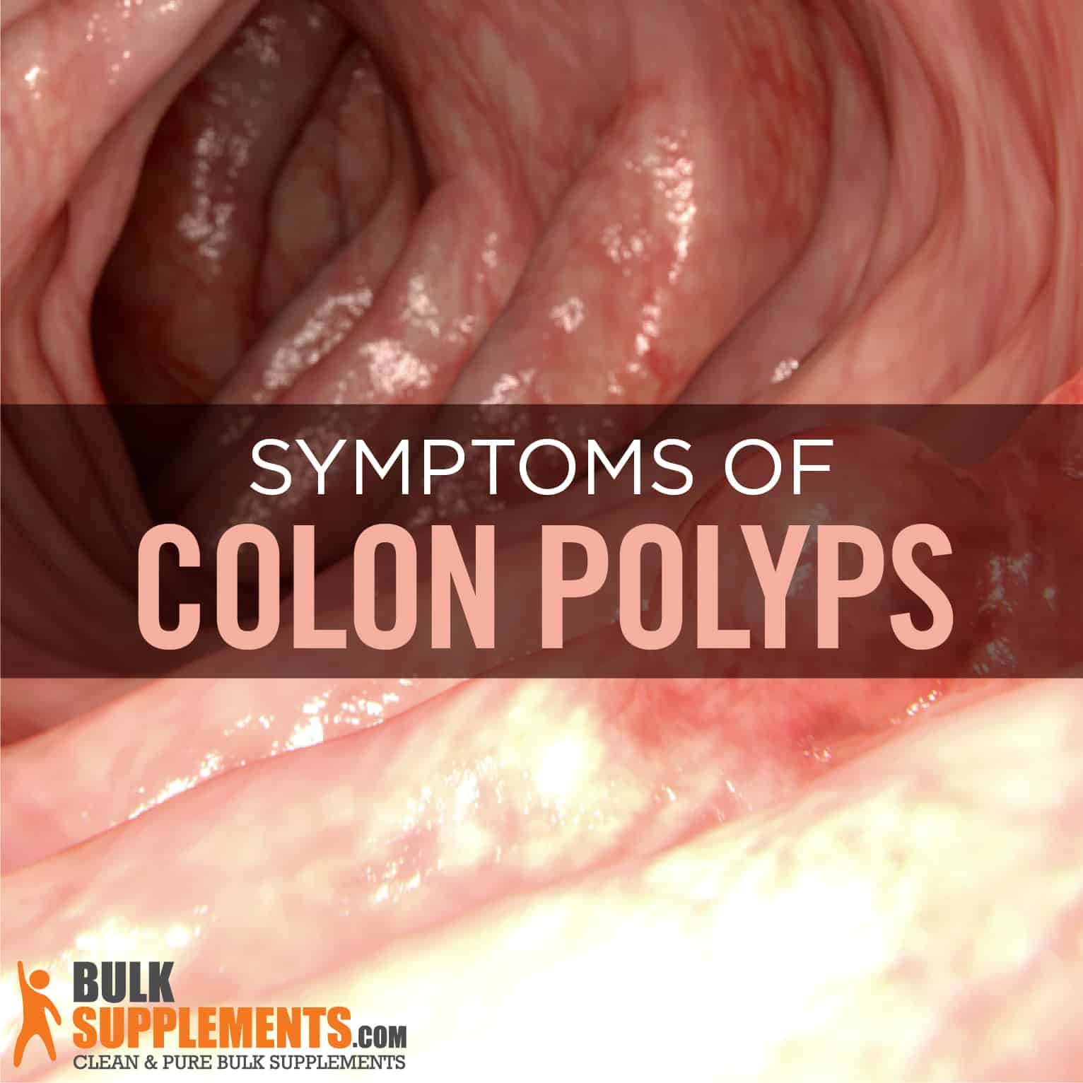 surgical removal of colon polyps
