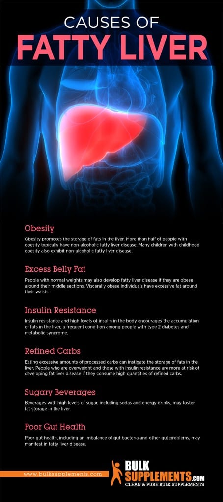 Fatty Liver Disease Symptoms Causes Treatment By James Denlinger