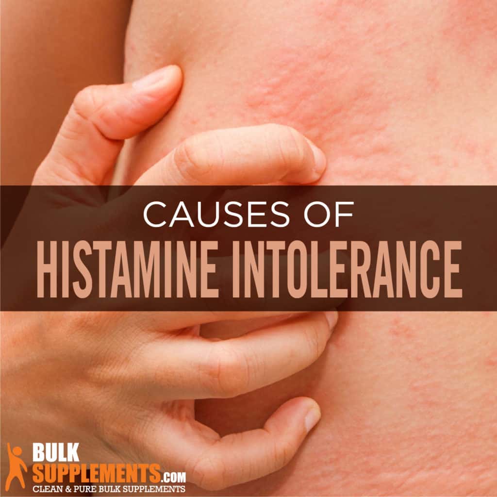 Histamine Intolerance Signs Causes Treatment