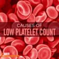 Low Platelet Count (Thrombocytopenia): Signs, Causes & Treatment