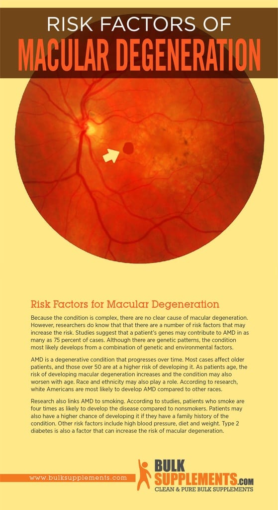Macular Degeneration Signs, Risk Factors & Treatment