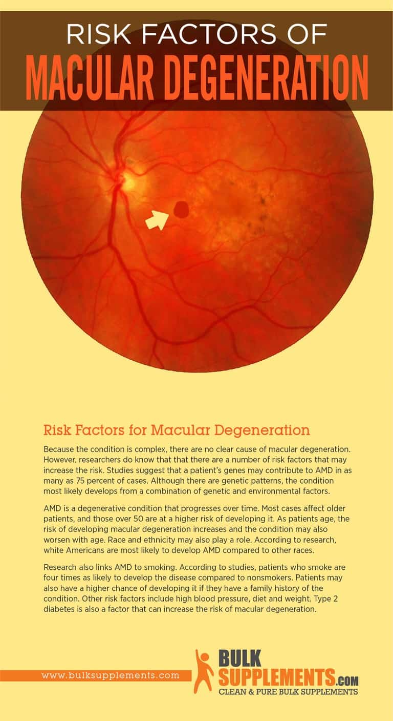 Macular Degeneration Signs, Risk Factors & Treatment