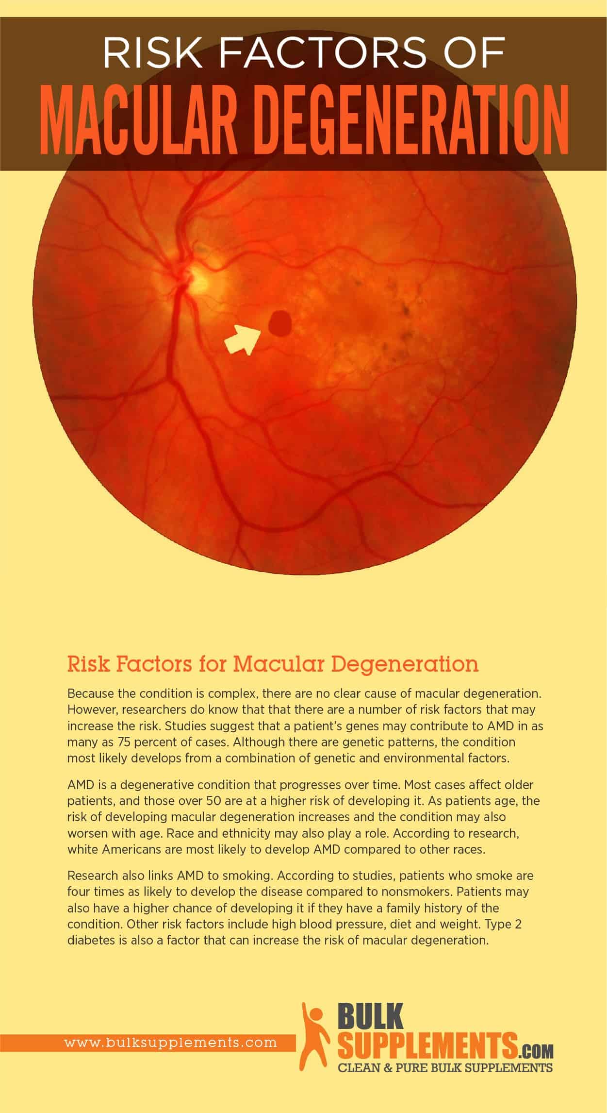 Macular Degeneration: Signs, Risk Factors & Treatment by James Denlinger