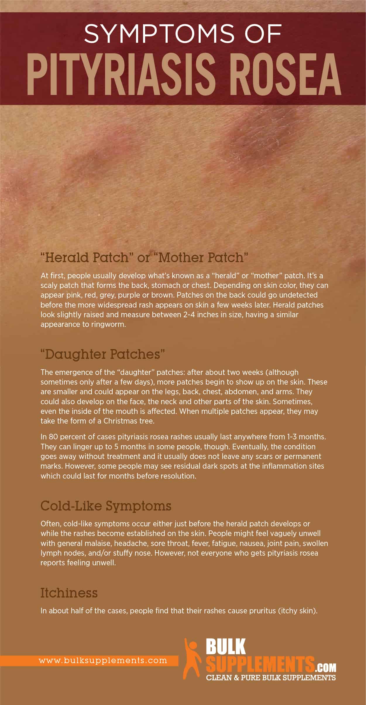 Symptoms of Pityriasis Rosea