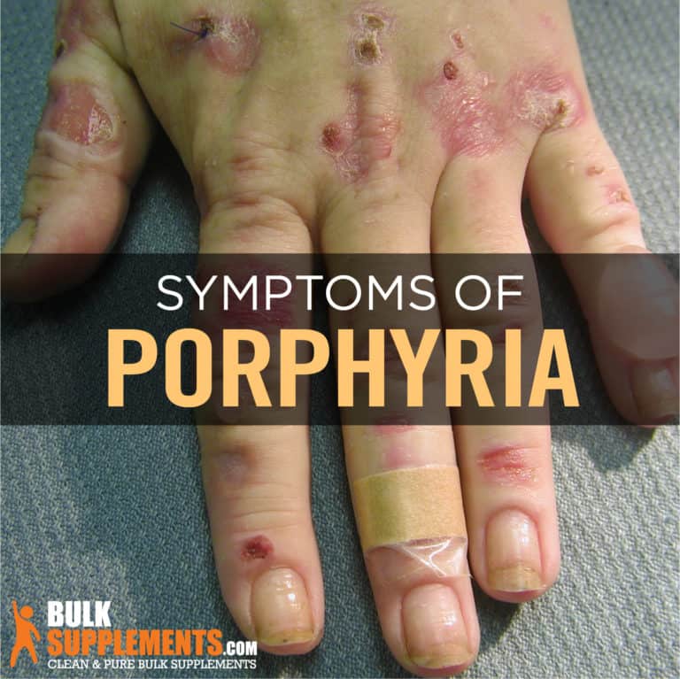 Porphyria Symptoms Causes And Treatments