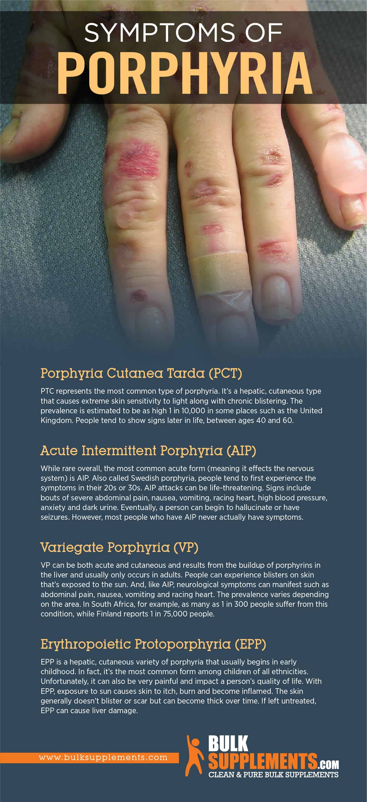 porphyria attack symptoms