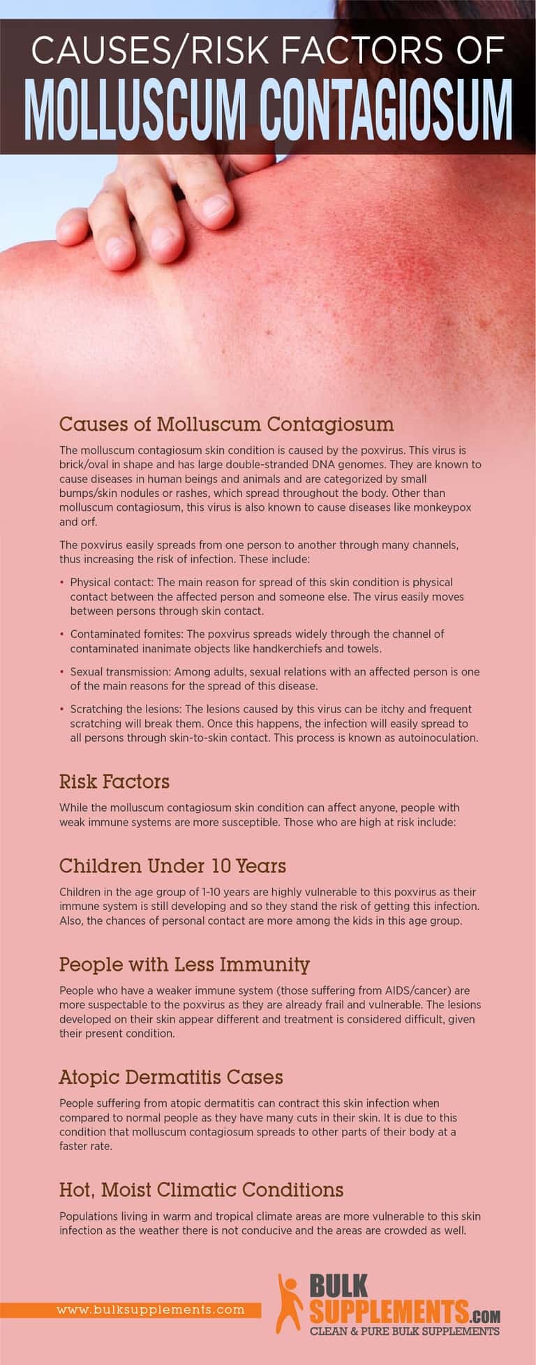 Molluscum Contagiosum Symptoms Causes Treatment And Life Cycle Hot Sex Picture 3841