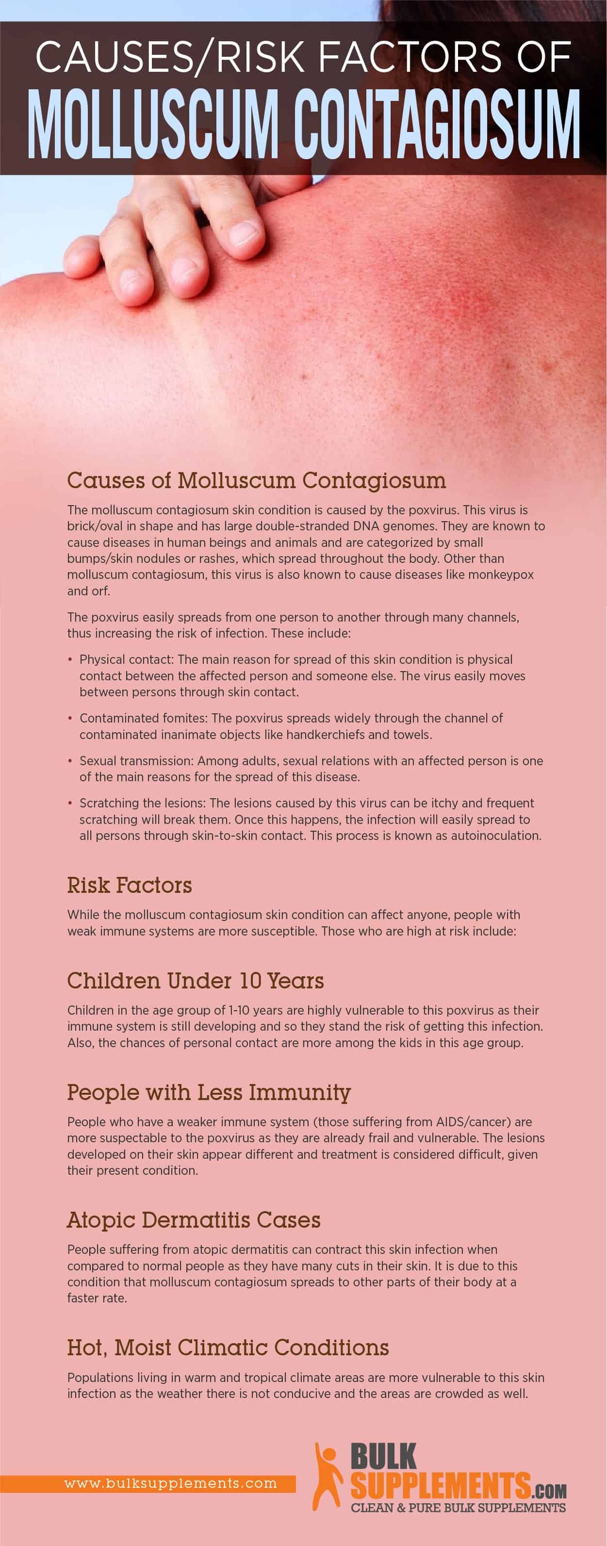 Causes/Risk Factors of Molluscum Contagiosum