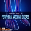 Peripheral Vascular Disease. Get Relief of Leg Pain with Our Supplements