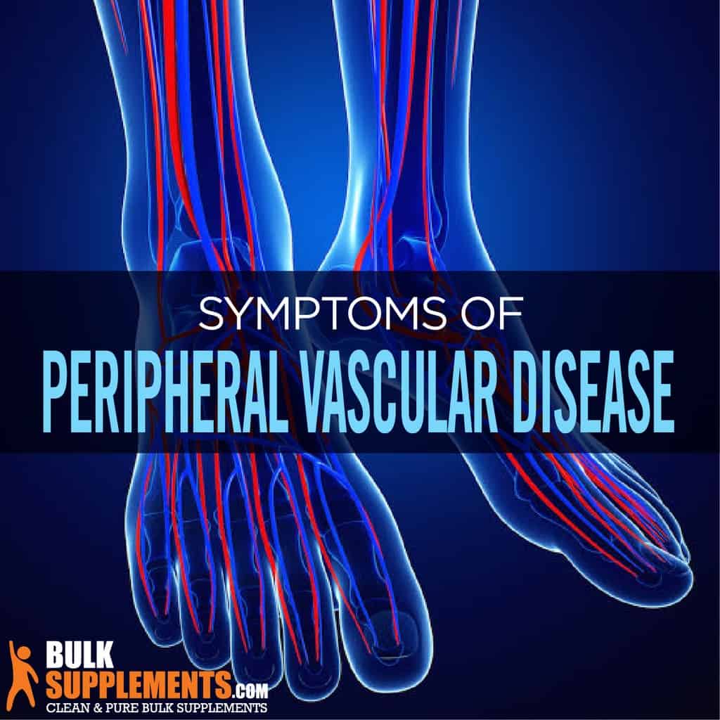 peripheral-vascular-disease-symptoms-causes-treatment