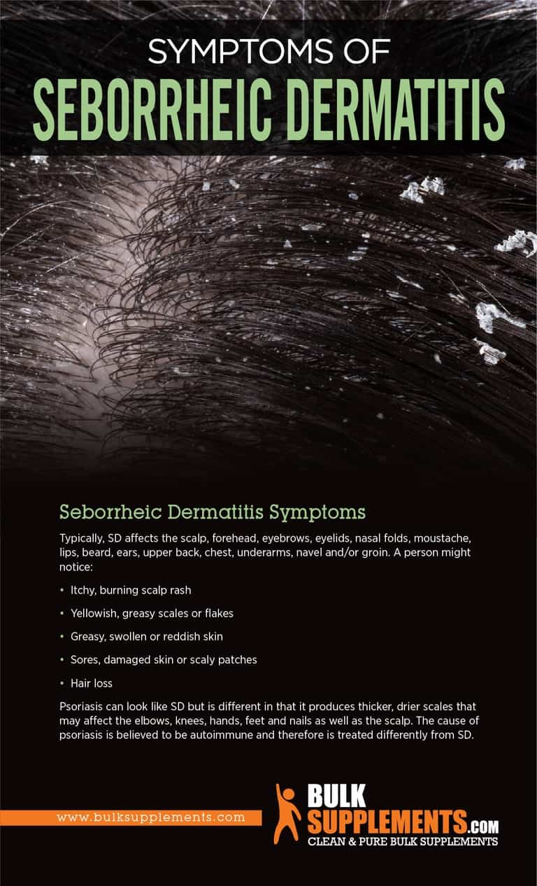 Seborrheic Dermatitis: Symptoms, Causes & Treatment