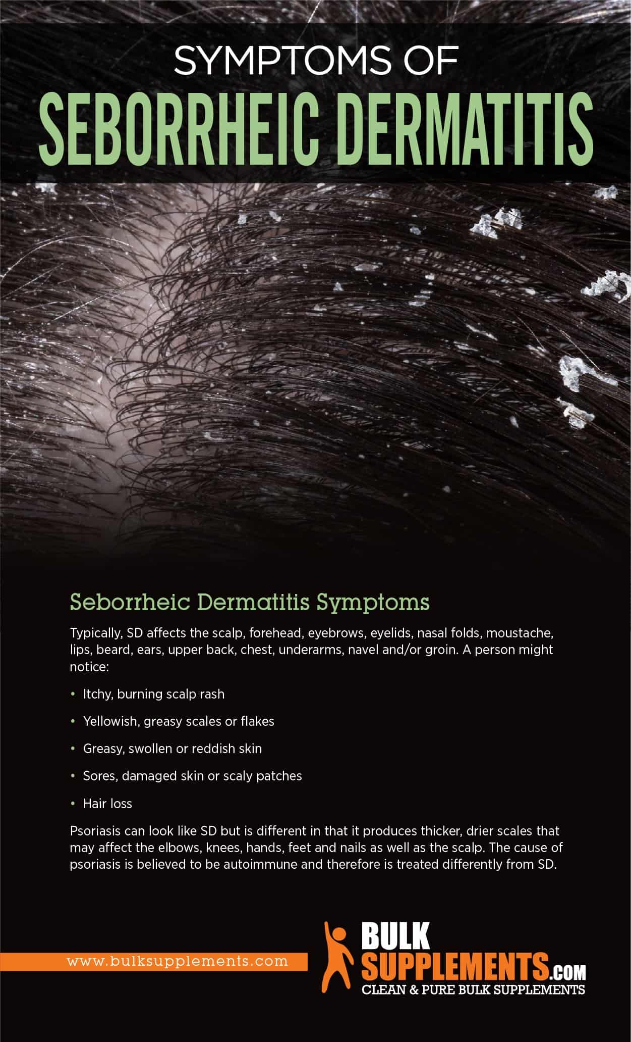 Symptoms of Seborrheic Dermatitis