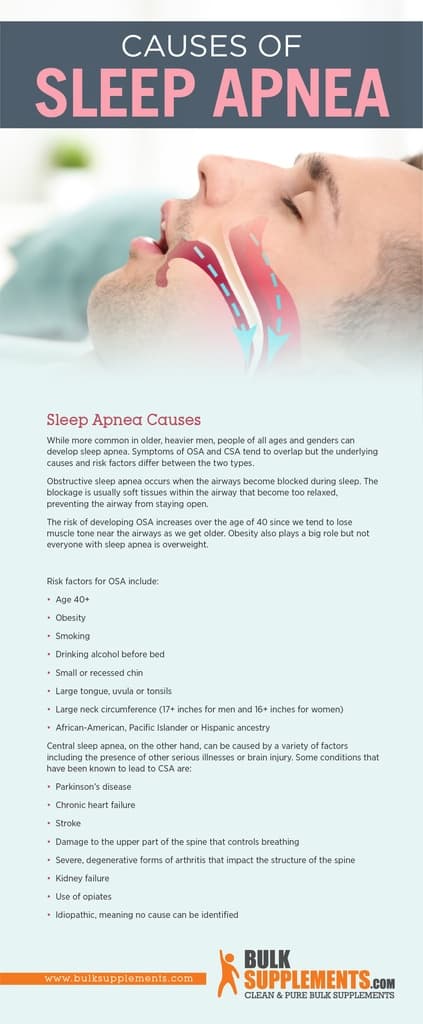 Sleep Apnea Causes Symptoms And Treatment 5564