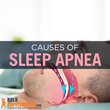 what is sleep apnea Archives