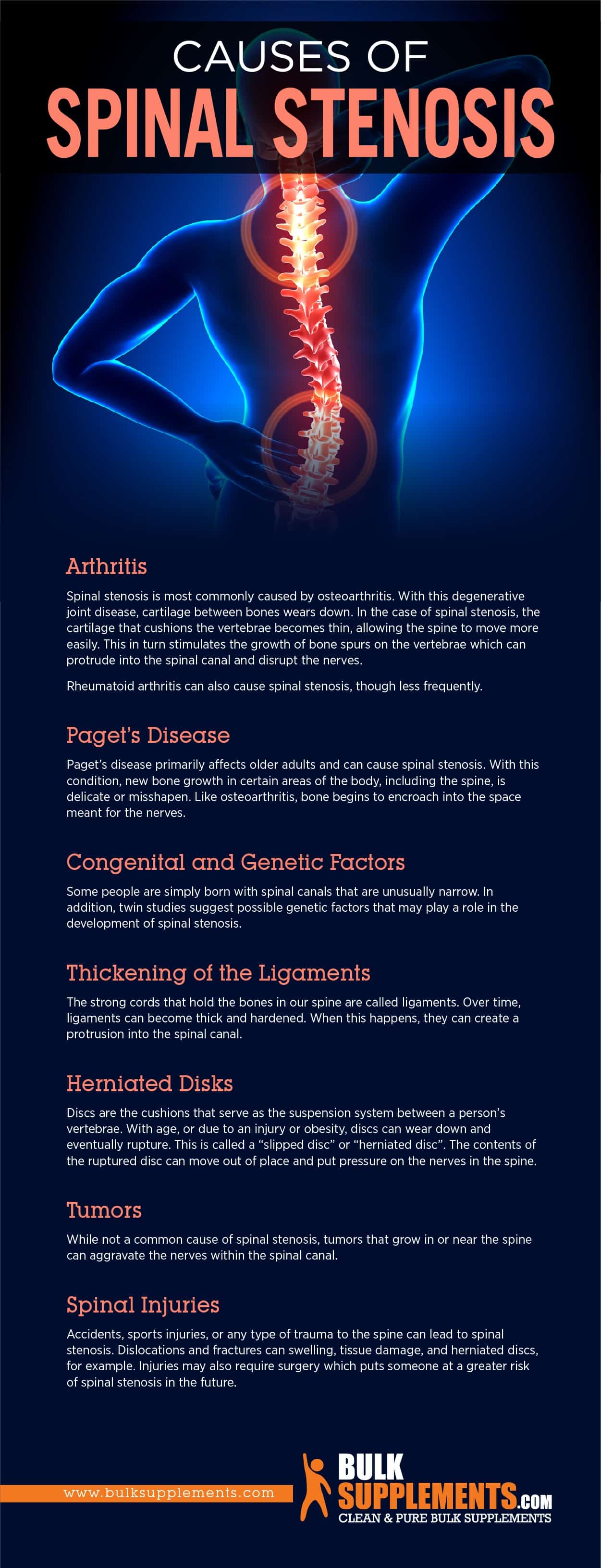 Causes of Spinal Stenosis